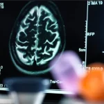 Yapay Zeka-3D Tasarım-Mebkit Robotik Kodlama Kursu-Onbirinci Grup